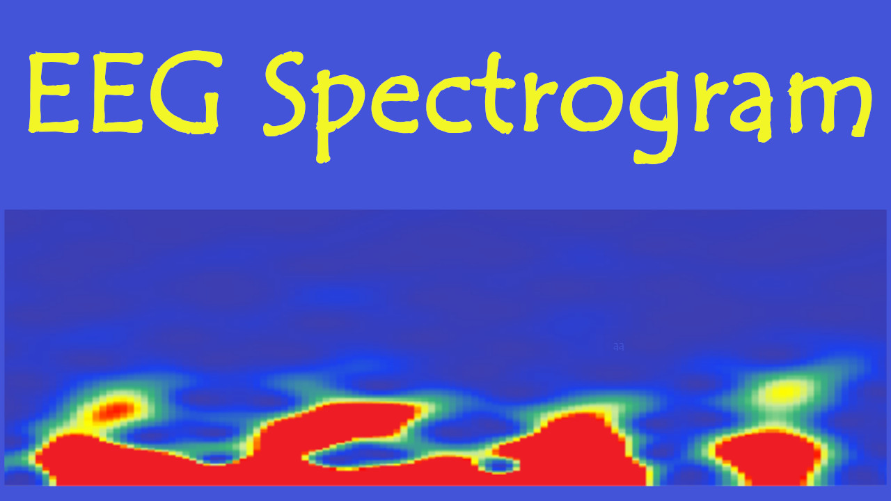 iEEG_Spectrogram